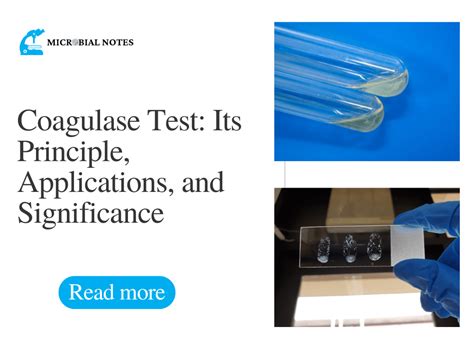 coagulase test results|Coagulase Test: Principle, Applications, and Significance .